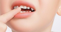 Çürük Dişler Fazla Kilo Almanıza Yol Açabilir